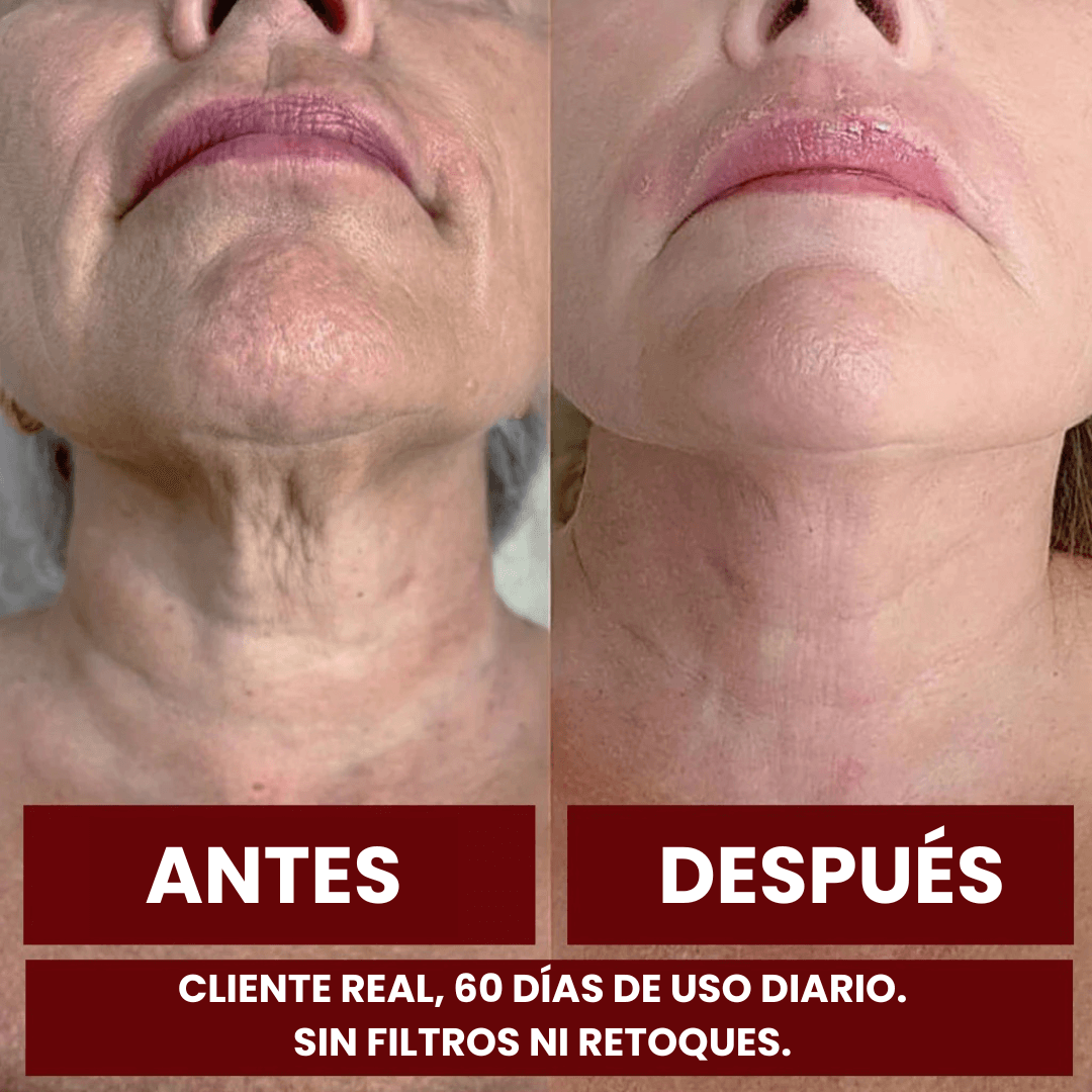 ZOOONE NAD+ Líquido | Terapia de Regeneración Avanzada