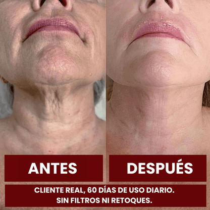 ZOOONE NAD+ Líquido | Terapia de Regeneración Avanzada